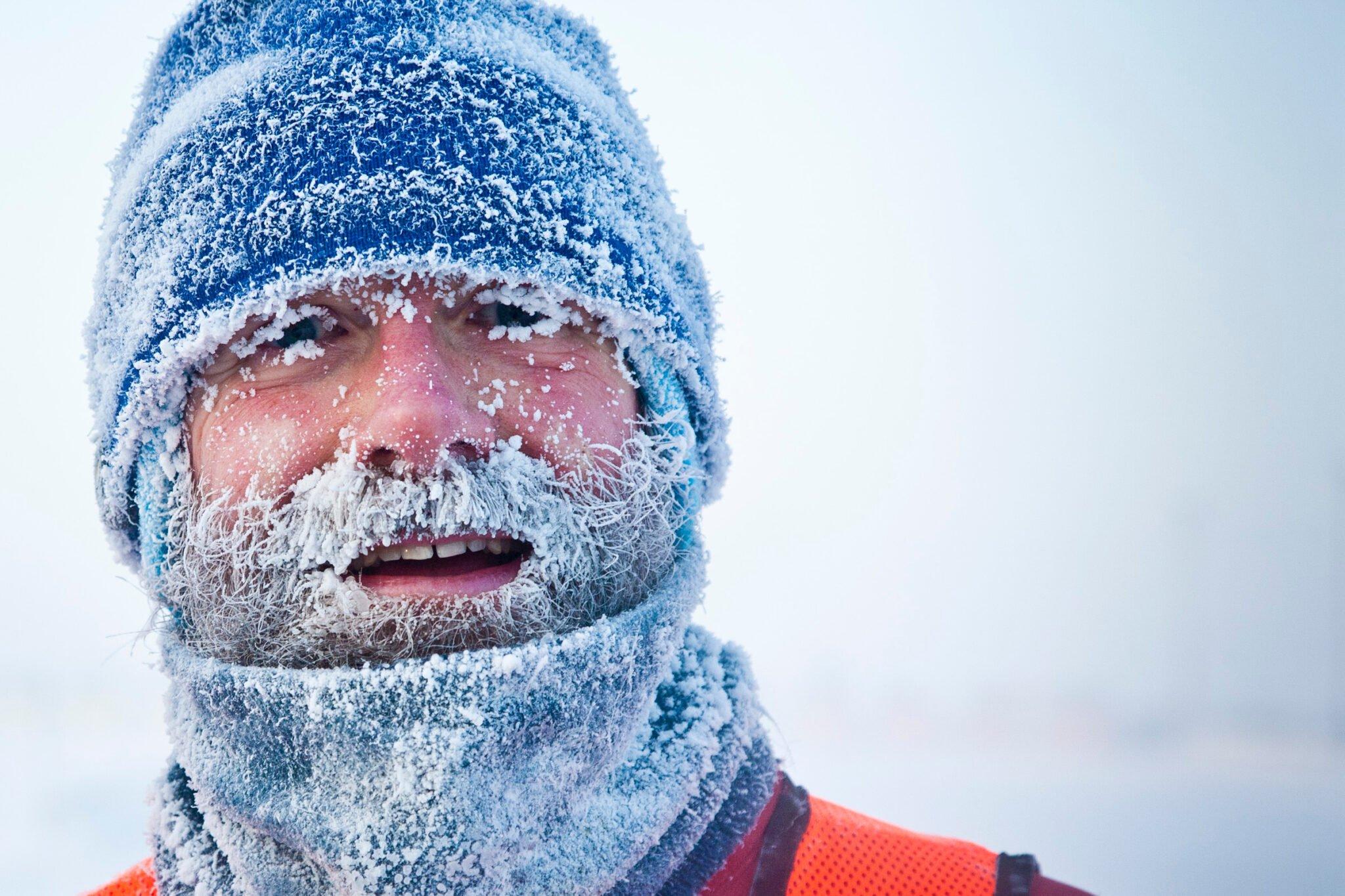 Зима в большом городе: как ухаживать за кожей лица в холодный период —  Косметология